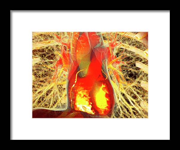 Lungs Framed Print featuring the photograph Heart And Lungs #1 by Antoine Rosset/science Photo Library