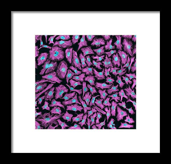 Abnormal Framed Print featuring the photograph HeLa cells, light micrograph #1 by Science Photo Library