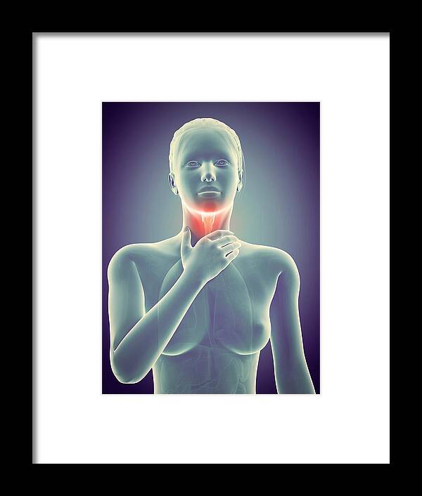 Artwork Framed Print featuring the photograph Inflammation Of The Larynx #1 by Sebastian Kaulitzki