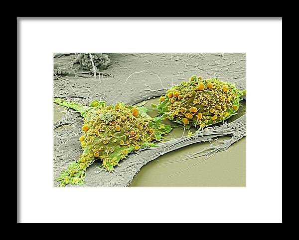 Anatomical Framed Print featuring the photograph Mesenchymal stem cells, SEM #1 by Science Photo Library