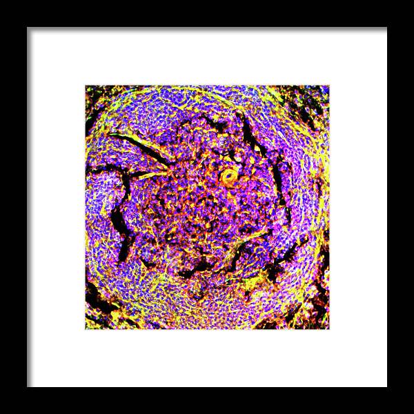 Pals Framed Print featuring the photograph Spleen Tissue #1 by R. Bick, B. Poindexter, Ut Medical School