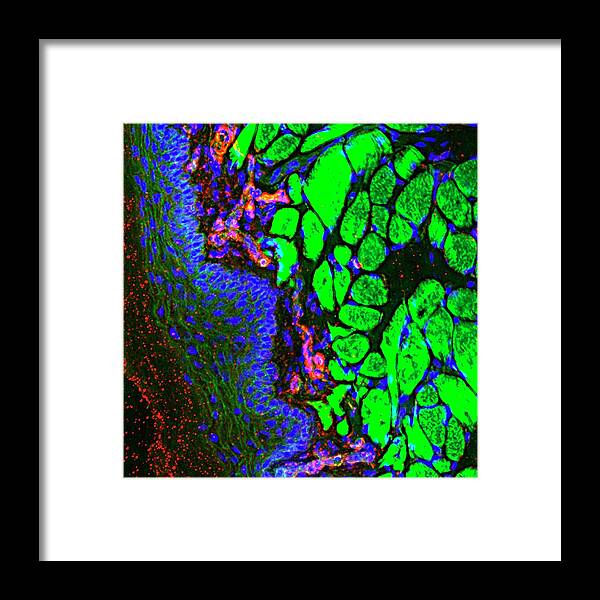 Actin Framed Print featuring the photograph Tongue Blood Vessels #1 by R. Bick, B. Poindexter, Ut Medical School