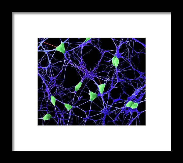 Central Nervous System Framed Print featuring the photograph Cortical Neurons #10 by Dennis Kunkel Microscopy/science Photo Library