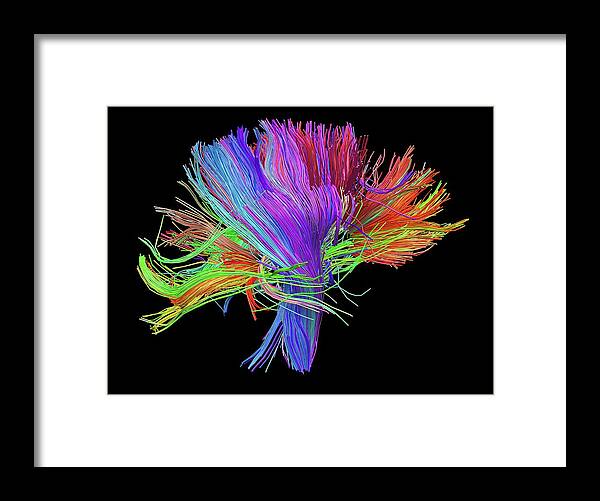 Brain Scan Framed Print featuring the photograph White Matter Fibres Of The Human Brain #11 by Alfred Pasieka