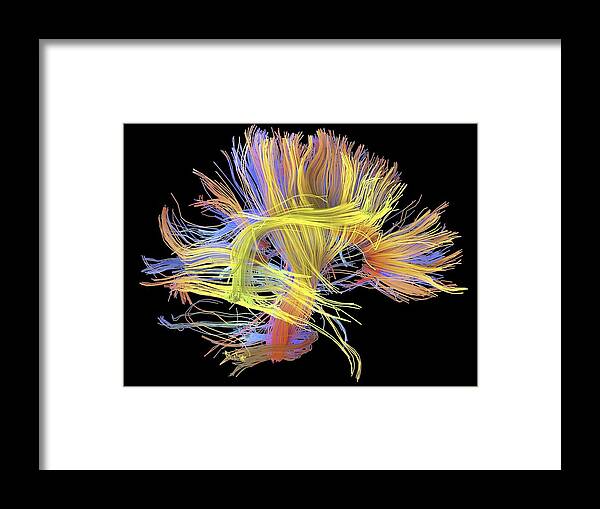  Framed Print featuring the photograph Untitled 1319 by Science Photo Library