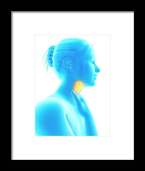Artwork Framed Print featuring the photograph Inflammation Of The Larynx #16 by Sebastian Kaulitzki