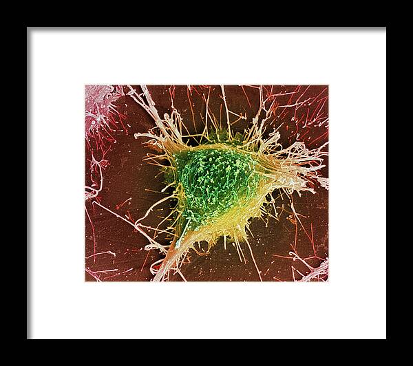 Alzheimer's Disease Framed Print featuring the photograph Alzheimer's Disease Culture Cell #2 by Simon Fraser/science Photo Library