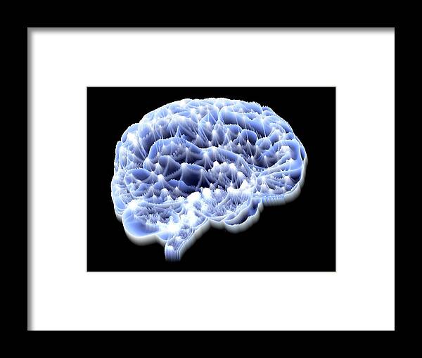 Brain Framed Print featuring the photograph Brain #2 by Alfred Pasieka/science Photo Library