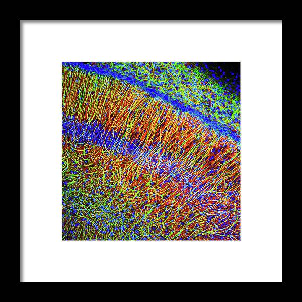 Anatomical Framed Print featuring the photograph Brain Cells by Dr. Chris Henstridge