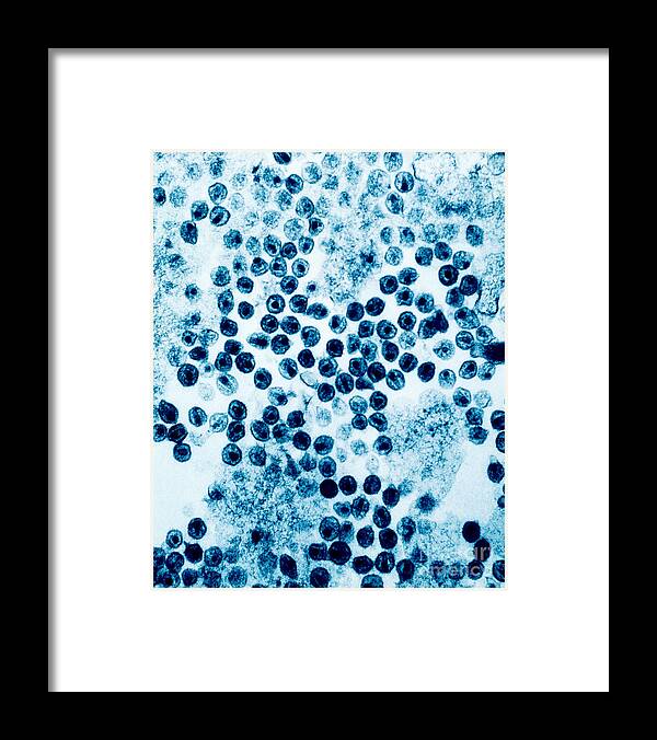 Aids Framed Print featuring the photograph Hiv Virus #2 by David M. Phillips