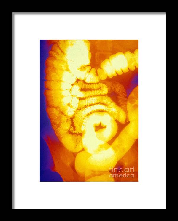 Medical Framed Print featuring the photograph Large And Small Intestine, Barium X-ray #2 by Susan Leavines