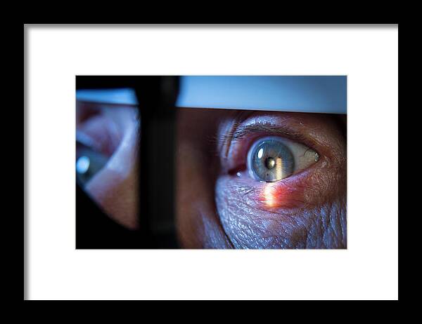 Human Framed Print featuring the photograph Slit-lamp Eye Examination #2 by Jim Varney/science Photo Library