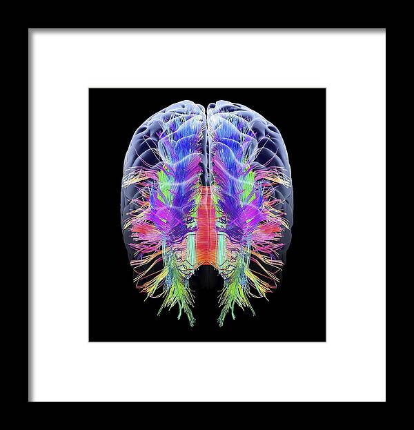 Brain Framed Print featuring the photograph White matter fibres and brain, artwork #2 by Science Photo Library