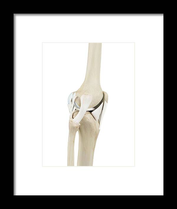 Artwork Framed Print featuring the photograph Human Knee Joint #20 by Sciepro