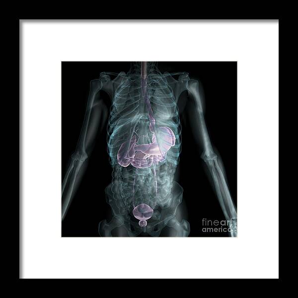 Abdomen Framed Print featuring the photograph The Digestive System #20 by Science Picture Co