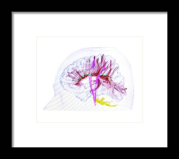 Brainstem Framed Print featuring the photograph Advanced Mri Brain Scan #3 by Philippe Psaila/science Photo Library