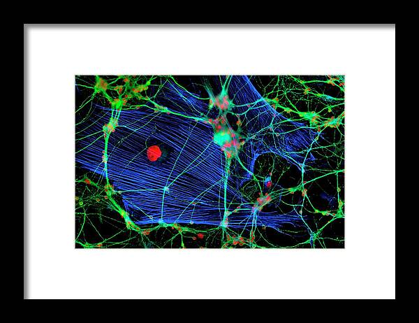 Glial Cell Framed Print featuring the photograph Glial Cells #3 by Dr Jan Schmoranzer/science Photo Library