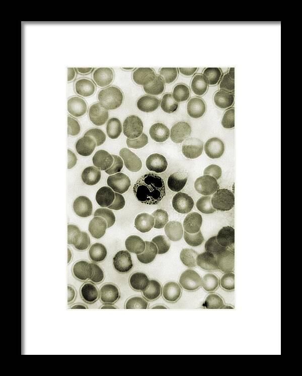 White Blood Cells Framed Print featuring the photograph Leukocyte, Drumstick, Lm #3 by Omikron