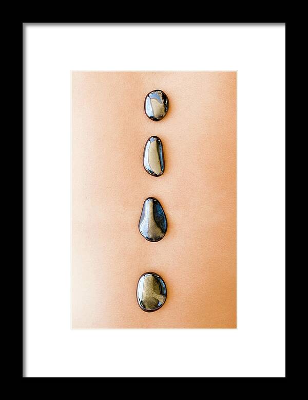 Equipment Framed Print featuring the photograph Stone Therapy #3 by Ian Hooton/science Photo Library