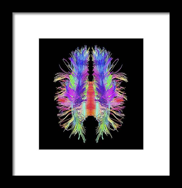 Brain Framed Print featuring the photograph White matter fibres and brain, artwork by Science Photo Library