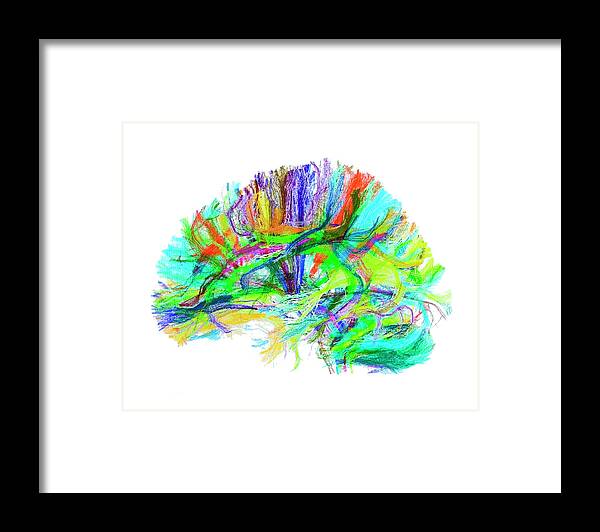 Brain Framed Print featuring the photograph Advanced Mri Brain Scan #4 by Philippe Psaila/science Photo Library