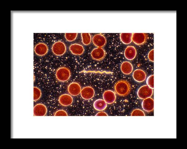 Bacteria Framed Print featuring the photograph Borrelia Burgdorferi, Lm by Michael Abbey