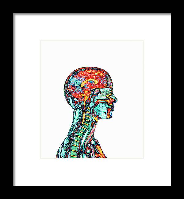Brain Framed Print featuring the photograph Brain And Spinal Cord by Mehau Kulyk