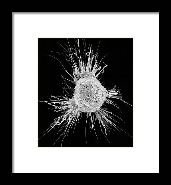 28798c Framed Print featuring the photograph Mouse Dendritic Cell #4 by Dennis Kunkel Microscopy/science Photo Library
