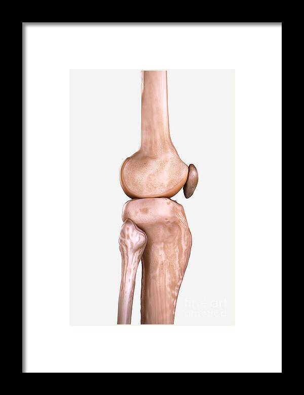 3d Visualisation Framed Print featuring the photograph Right Knee Bones #4 by Science Picture Co