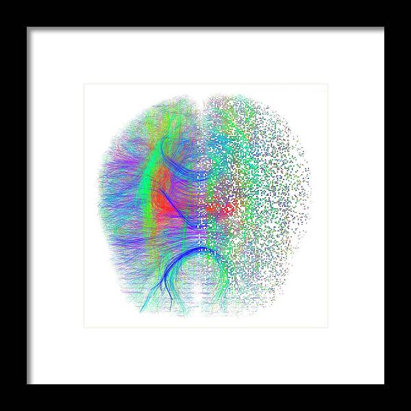 Brain Scan Framed Print featuring the photograph Brain White Matter Fibres Dissolving #5 by Alfred Pasieka/science Photo Library