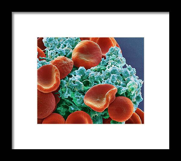 Activated Framed Print featuring the photograph Red Blood Cells And Platelets #5 by Steve Gschmeissner