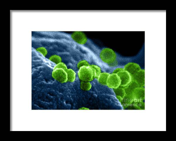 Science Framed Print featuring the photograph Aids Virus #7 by Dr Cecil H Fox