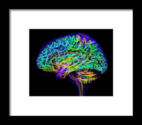 Organ Framed Print featuring the photograph Human Brain #6 by K H Fung/science Photo Library
