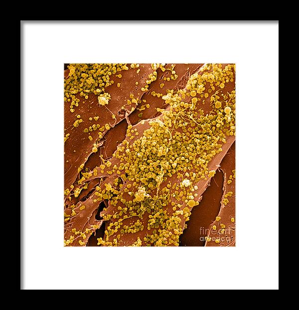 Cell Framed Print featuring the photograph Human Skin Cell Sem by David M. Phillips