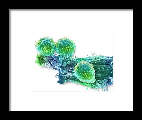 Antigen Framed Print featuring the photograph Cancer Cell And T Lymphocytes #7 by Steve Gschmeissner