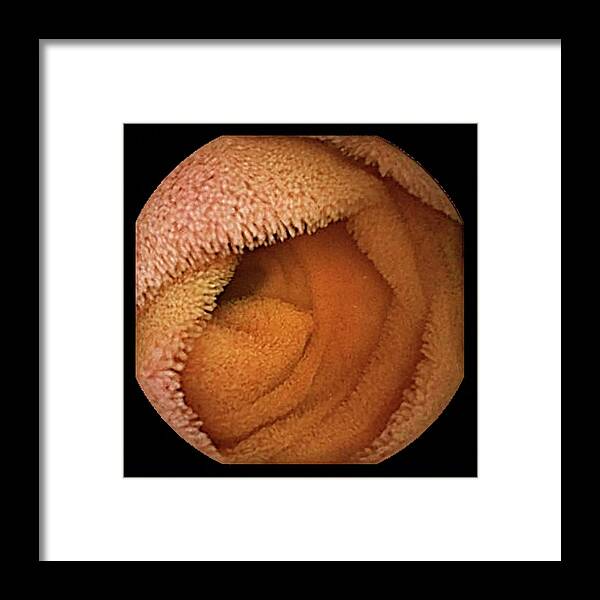 Alimentary Canal Framed Print featuring the photograph Small Intestine #7 by Gastrolab