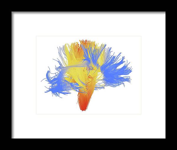 Brain Scan Framed Print featuring the photograph White Matter Fibres Of The Human Brain #8 by Alfred Pasieka