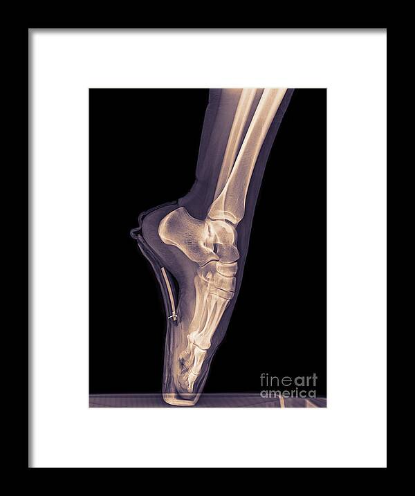 Point Framed Print featuring the photograph Ballet Dancer x-ray 3 by Guy Viner