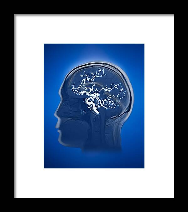 Kyoto Prefecture Framed Print featuring the photograph blood vessel with human brain MRI by Yuji Sakai