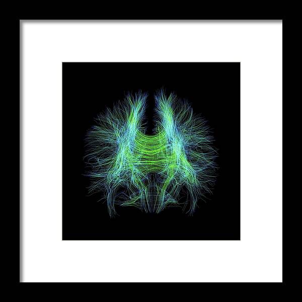 Nerve Fibre Framed Print featuring the photograph Brain Fibres by Sherbrooke Connectivity Imaging Lab/science Photo Library