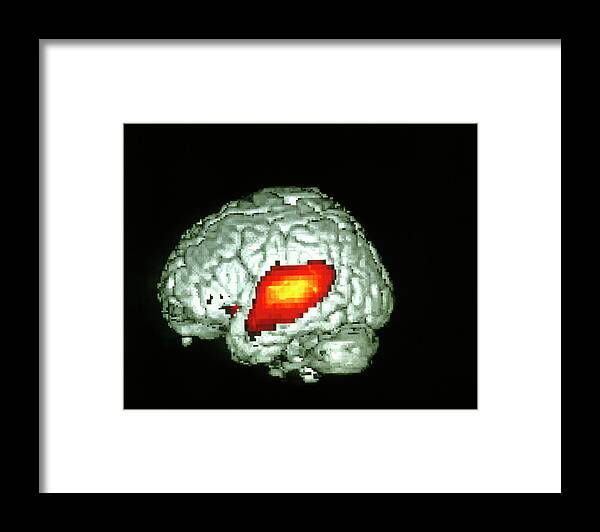 Hearing Framed Print featuring the photograph Brain Hearing Sound by Wellcome Dept. Of Cognitive Neurology/ Science Photo Library