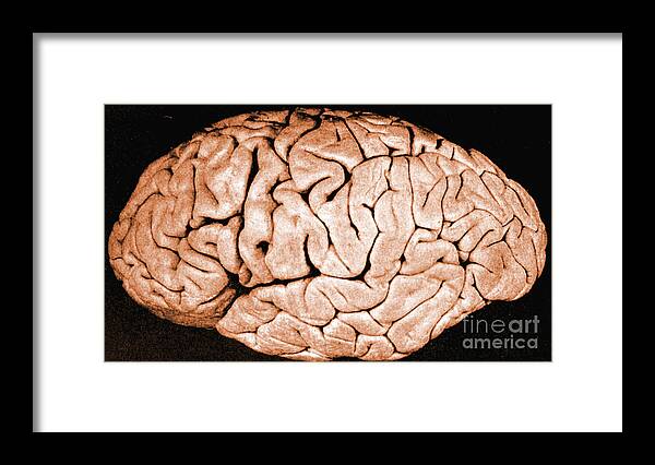 Historic Framed Print featuring the photograph Brain Of Helen Hamilton Gardener by Science Source