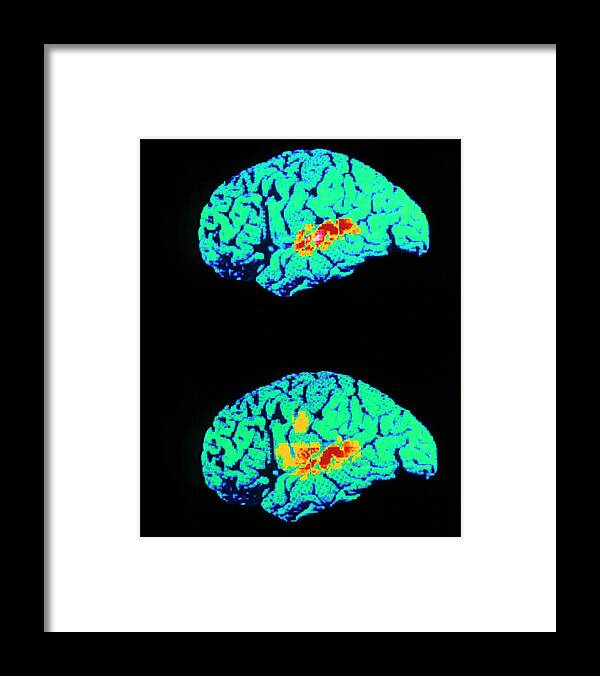 Anatomy Framed Print featuring the photograph Brain Scan When Listening Repeat Words by Wellcome Dept. Of Cognitive Neurology/ Science Photo Library