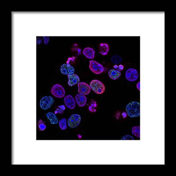 Science Framed Print featuring the photograph Colorectal Cancer Cells Damaged By Atr by Science Source