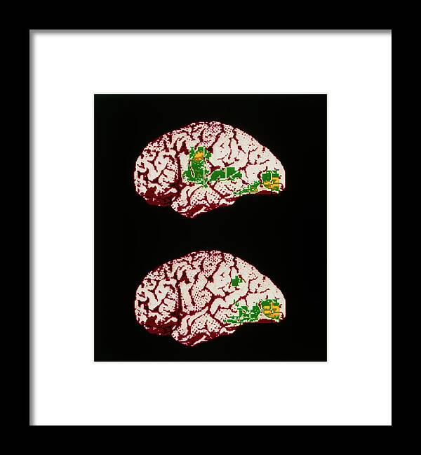 Reading Framed Print featuring the photograph Colour Pet Brain Scan When Reading Aloud/silently by Wellcome Dept. Of Cognitive Neurology/ Science Photo Library