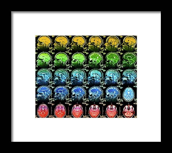 Brain Framed Print featuring the photograph Coloured Mri Scans Of A Healthy Human Brain by Simon Fraser/science Photo Library