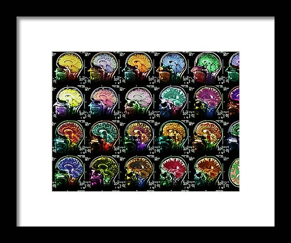 Brain Framed Print featuring the photograph Coloured Sagittal Mri Scans Of The Human Brain by Simon Fraser/science Photo Library
