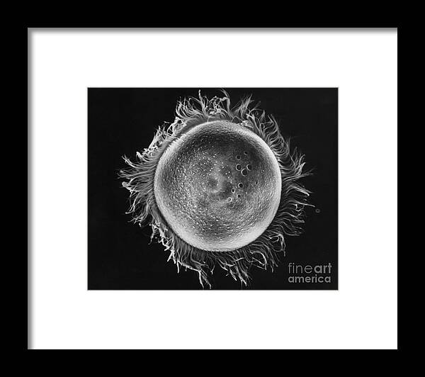 B&w Framed Print featuring the photograph Didinium Nasutum Ciliate Sem by Greg Antipa
