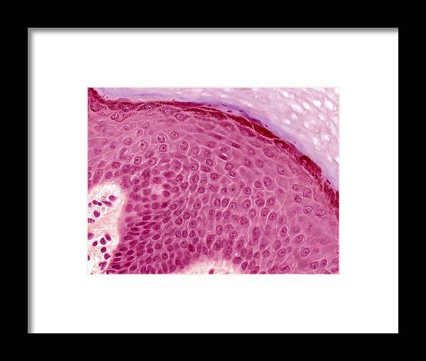 Skin Framed Print featuring the photograph Epidermis Lm by Alvin Telser