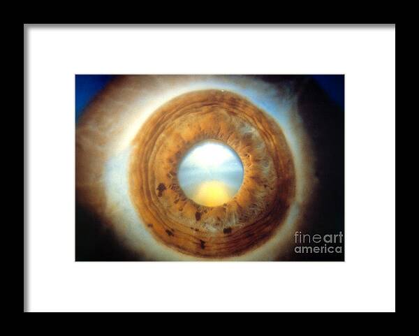 Eye Framed Print featuring the photograph Eye by Ralph C Eagle Jr